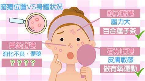 下巴生暗瘡解決方法|下巴生暗瘡是內分泌失調嗎？生暗瘡原因、超有效解決方法分享 –